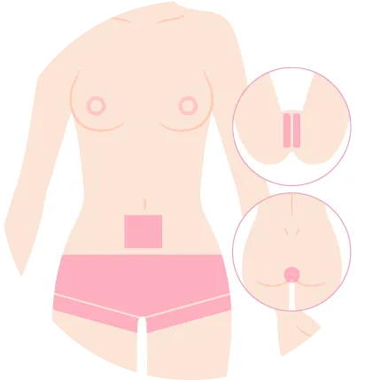 顔Sパーツを示すイラスト