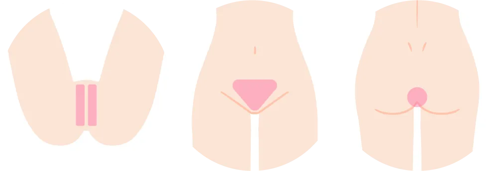 VIOを示すイラスト