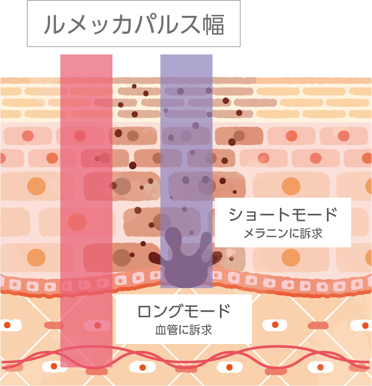 ルメッカパルス幅