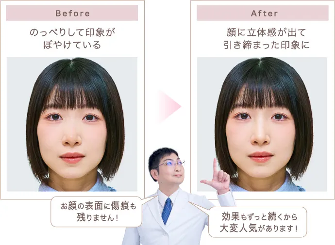 のっぺりした印象から顔に立体感が出て引き締まった印象に