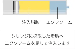 シリンジに採取した脂肪へエクソソームを足して注入します