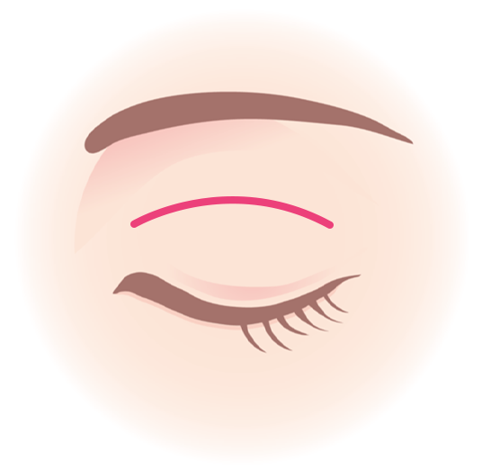 01,デザイン・マーキングの説明画像