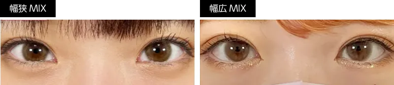 MIX型幅狭・幅広比較画像