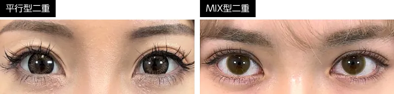平行型・MIX型二重比較