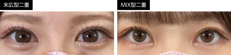 末広型とMIX型の比較