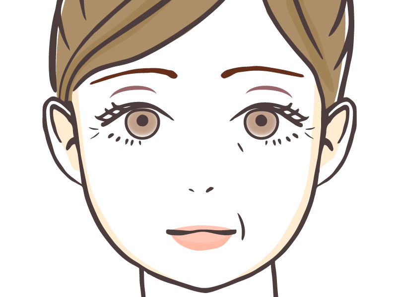 まぶたが痩せるイラスト