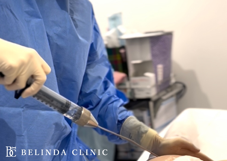 まりこ先生によるシリンジ吸引