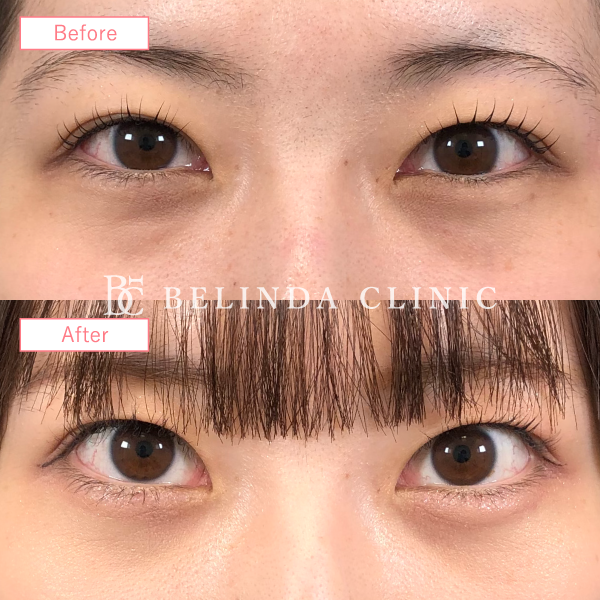 クマ取り症例No2493