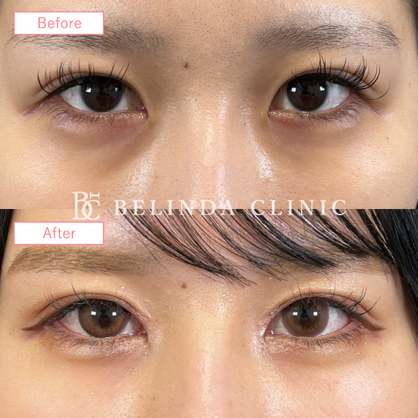 グラマラスライン症例No3857