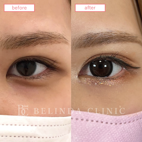 グラマラスライン症例No661