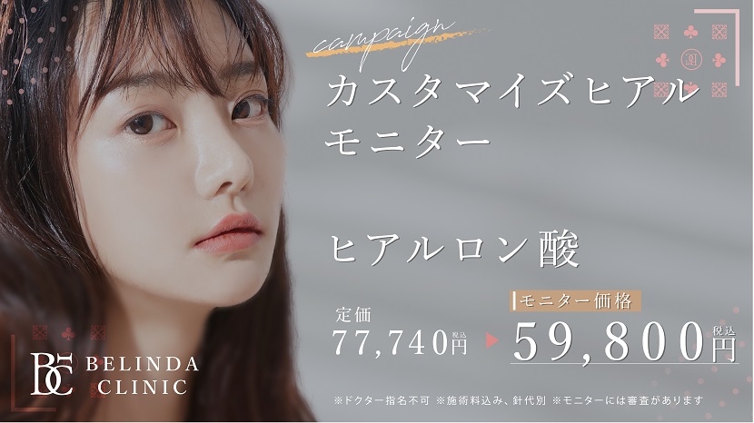 カスタマイズヒアルFV