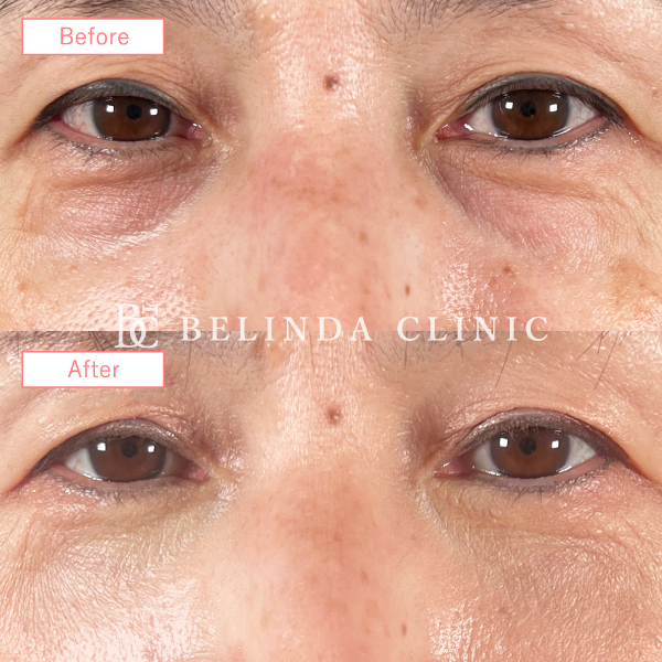 ルメッカビフォーアフターcase01