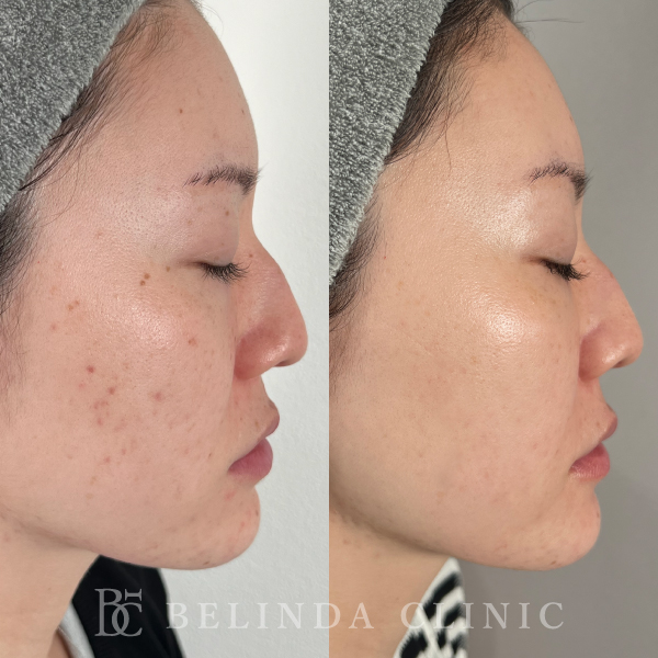 ルメッカビフォーアフターcase02