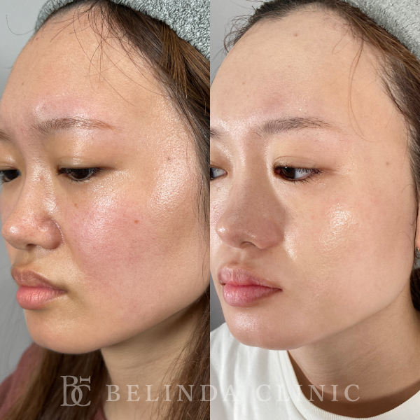 ルメッカビフォーアフターcase03