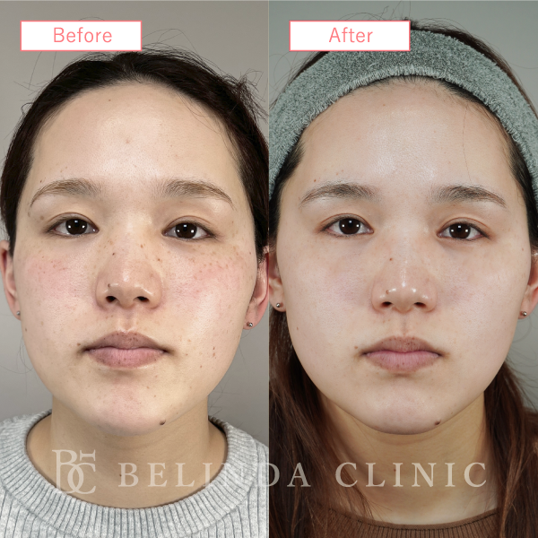 ルメッカ症例No1097