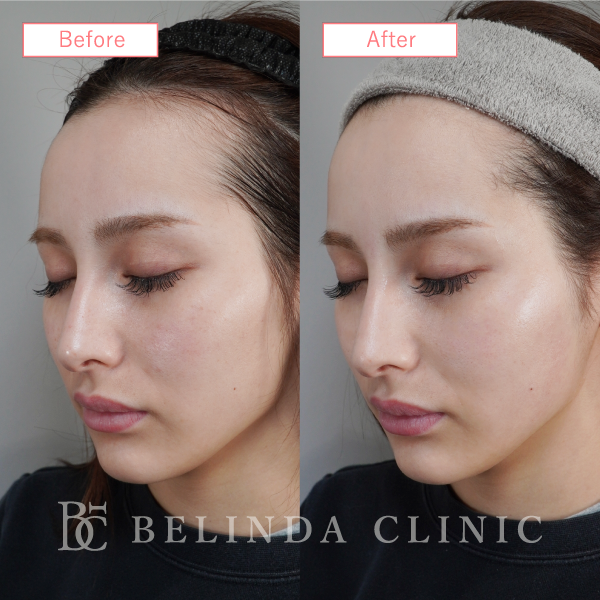 ルメッカビフォーアフターcase09