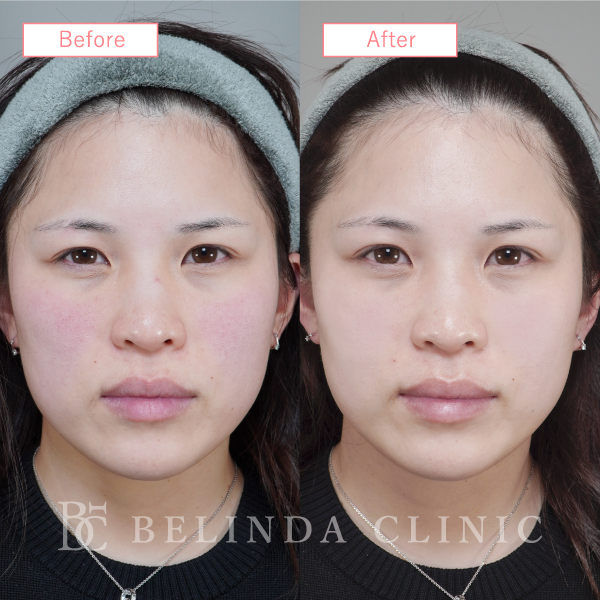 ルメッカビフォーアフターcase12