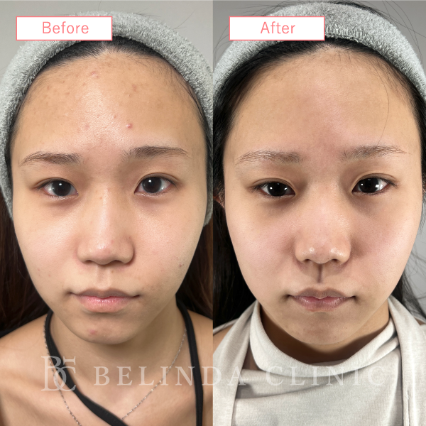 ルメッカビフォーアフターcase06